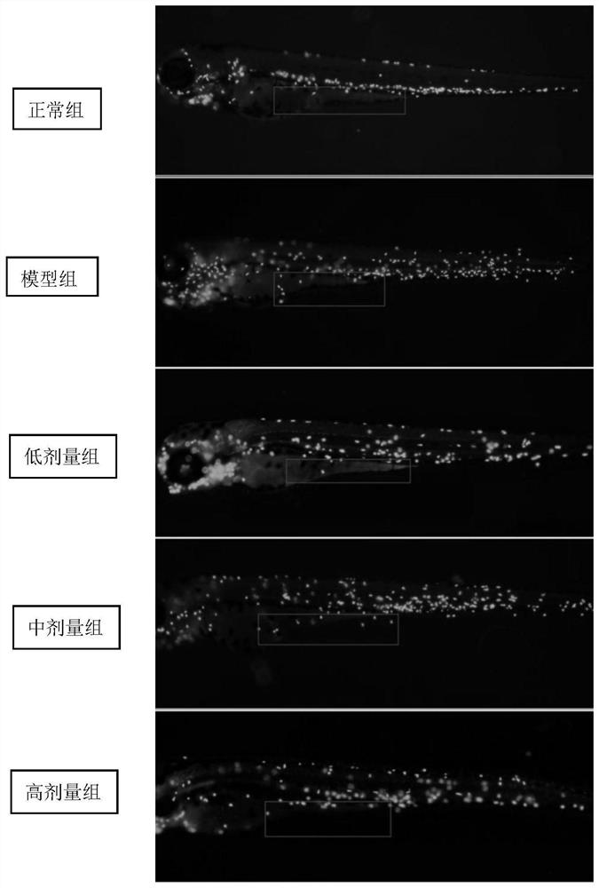 Combination preparation of fucoidan and its application