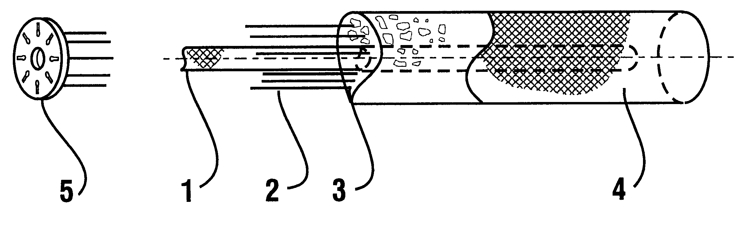 Injection anchor