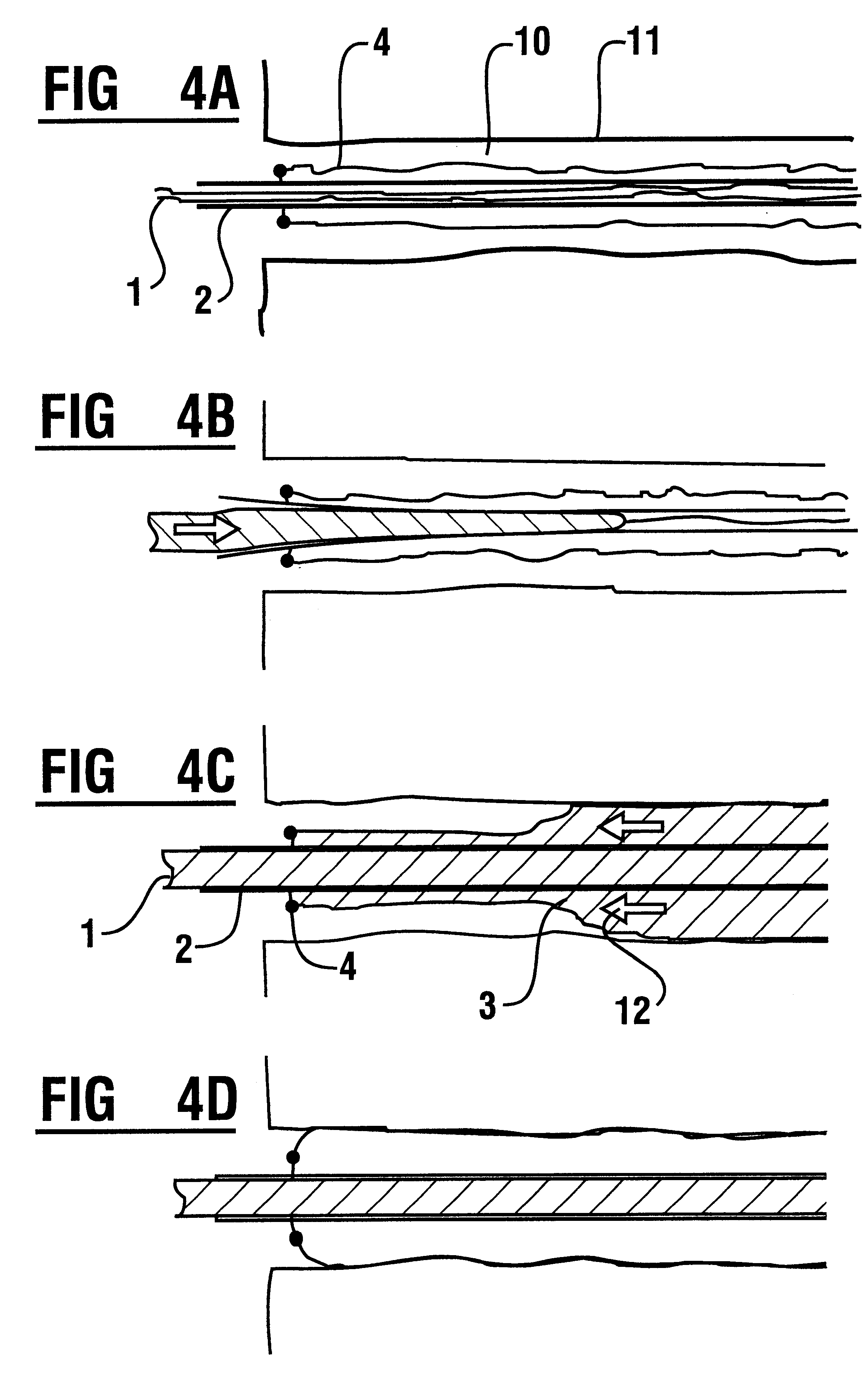 Injection anchor