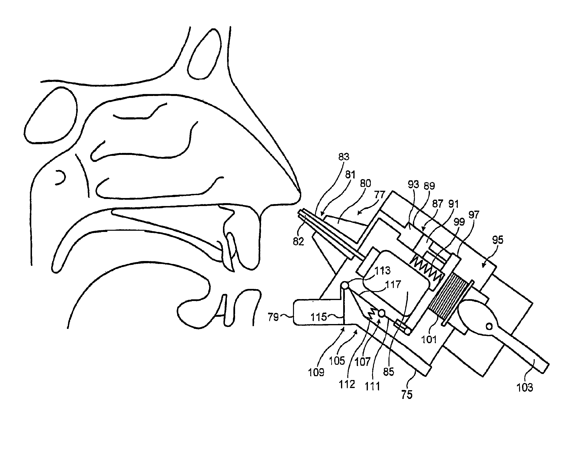 Nasal devices