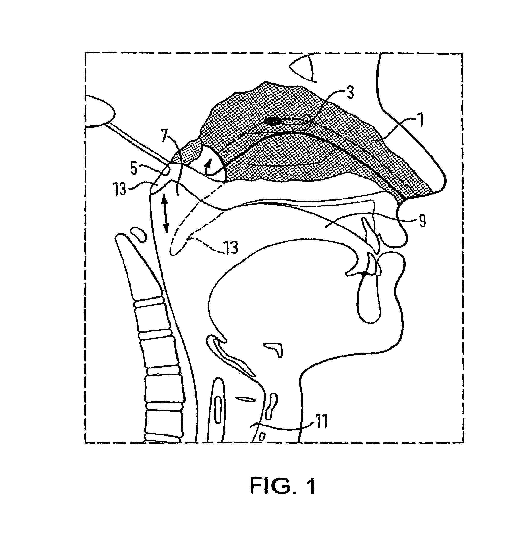 Nasal devices