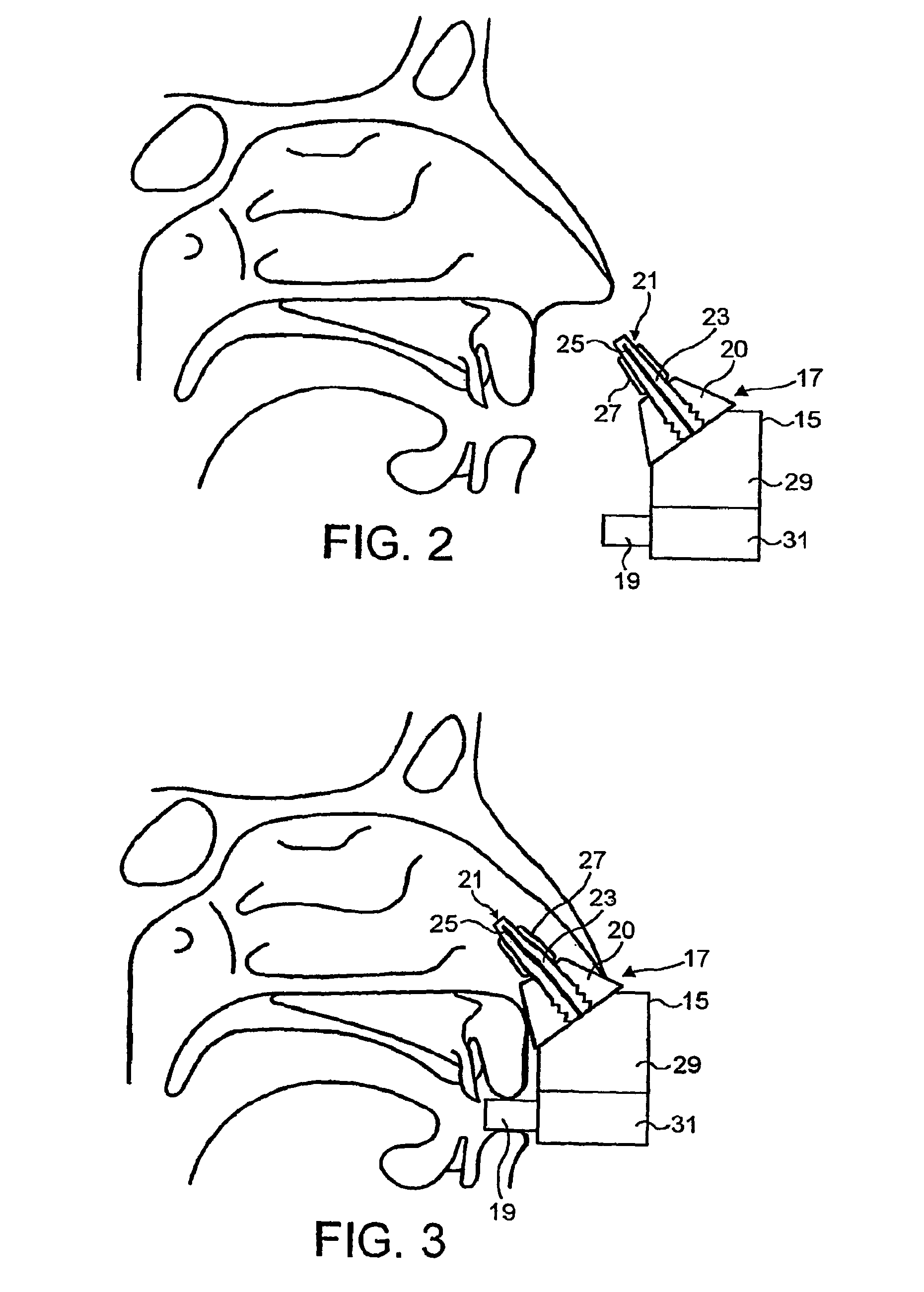 Nasal devices