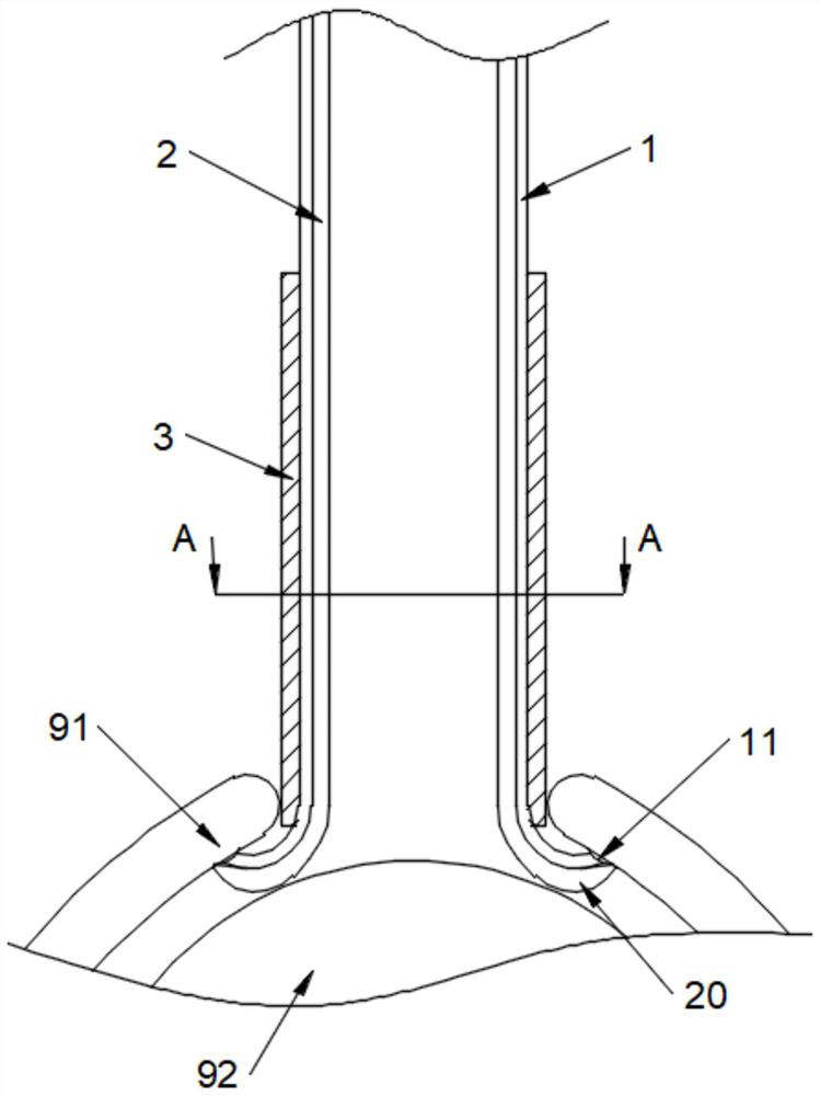 A device for measuring cervical dilation