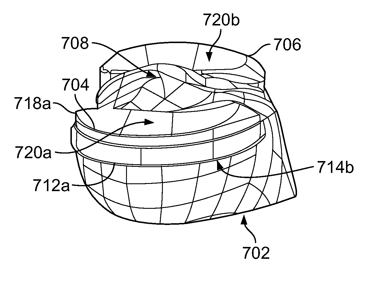 Morphologically curved sagittal wall of a tibial implant