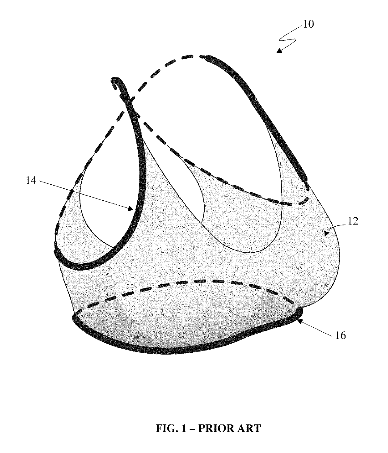 Breast support garment