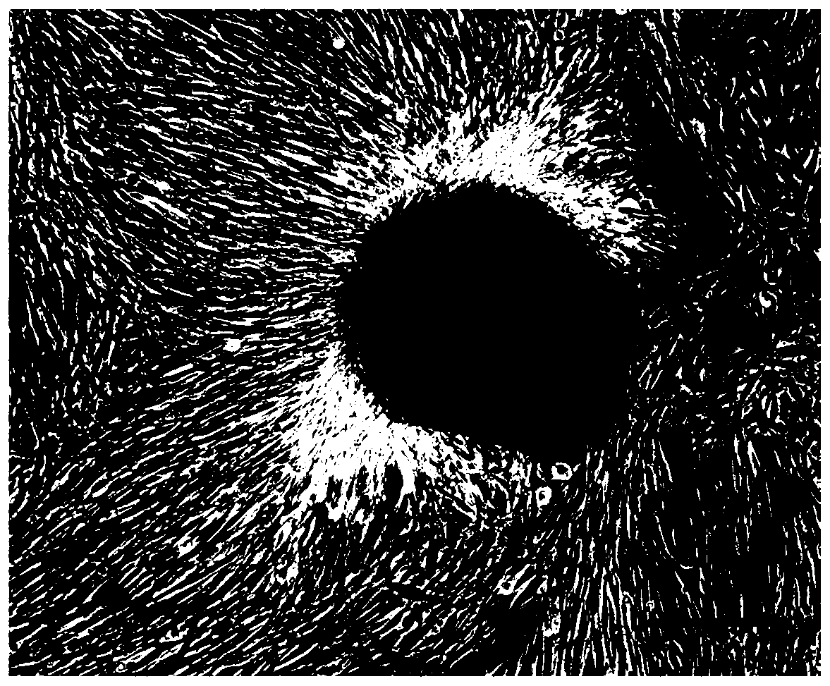 A kind of preparation method of humanized active decellularized corneal stroma scaffold