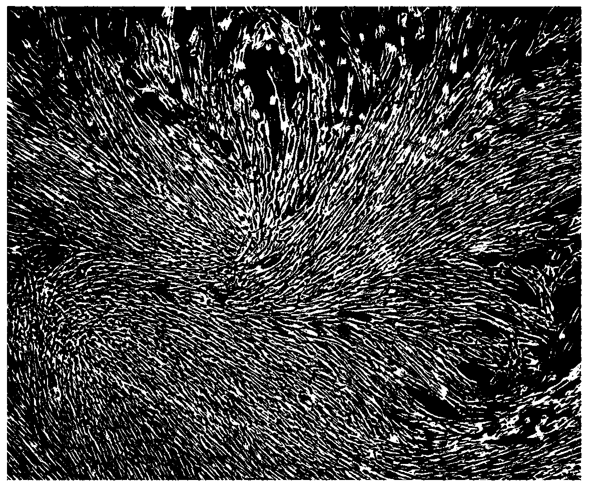 A kind of preparation method of humanized active decellularized corneal stroma scaffold