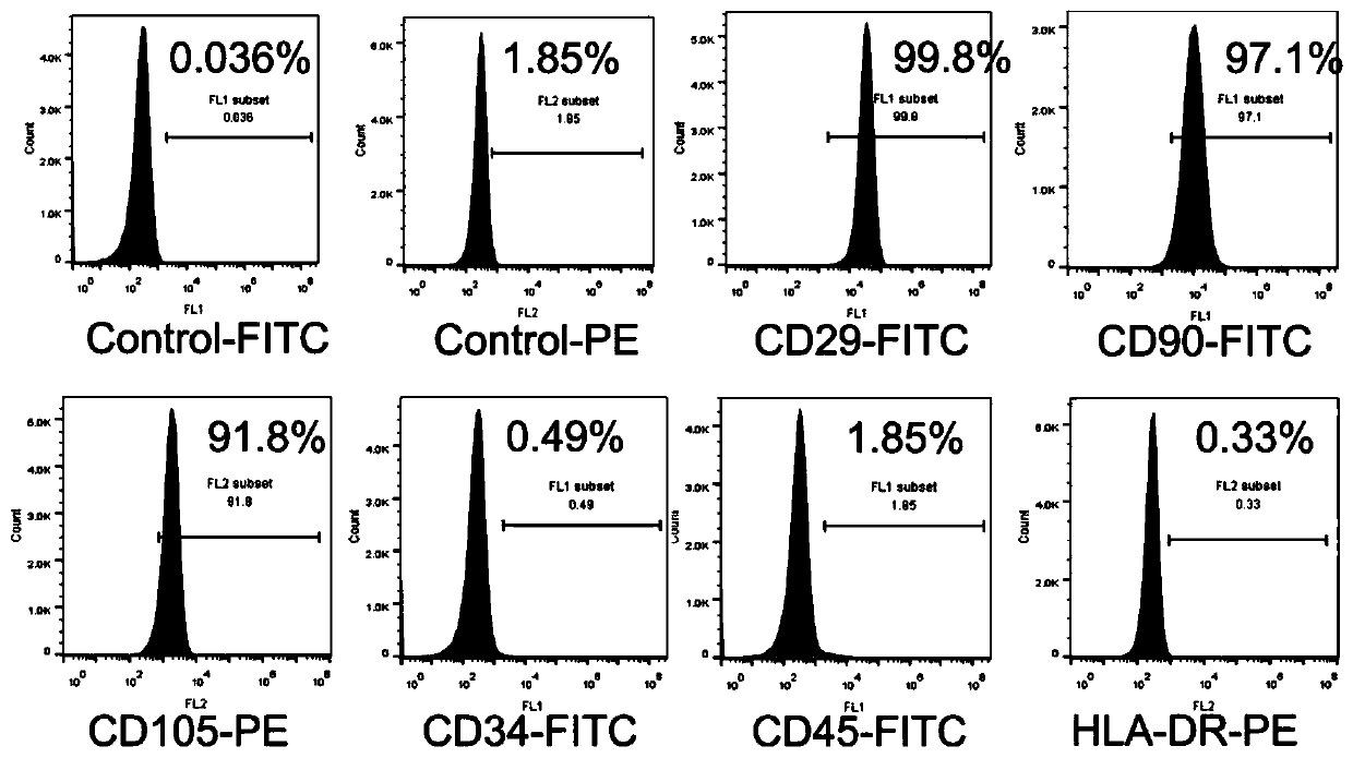 A kind of preparation method of humanized active decellularized corneal stroma scaffold