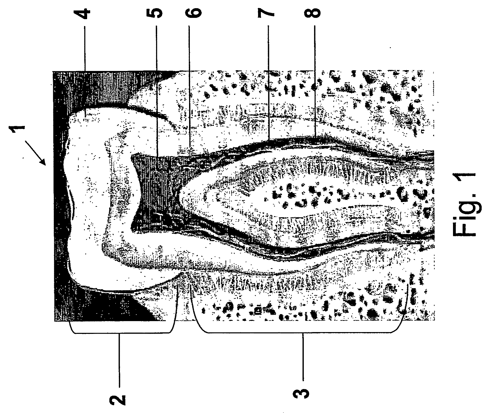 Self Adjusting Instrument