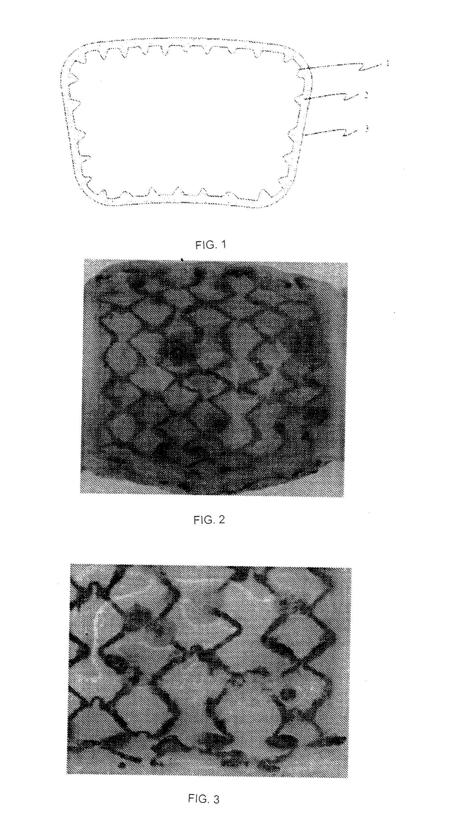 Absorbable Iron Alloy Stent