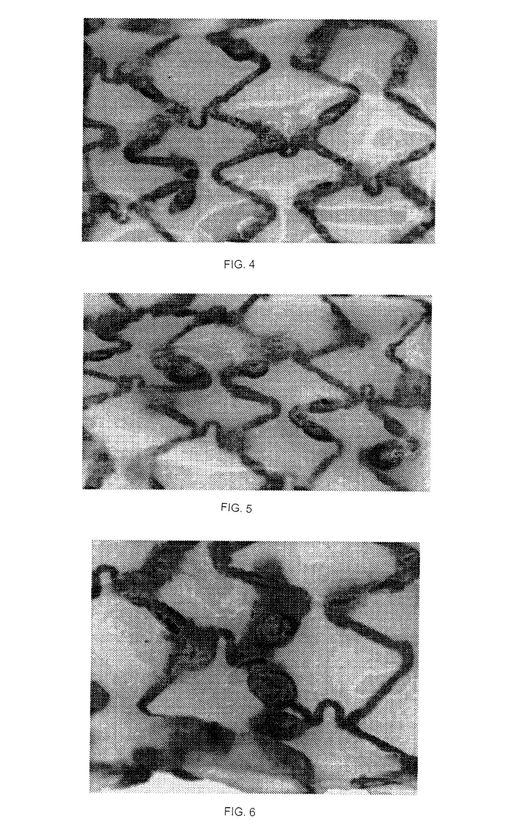 Absorbable Iron Alloy Stent