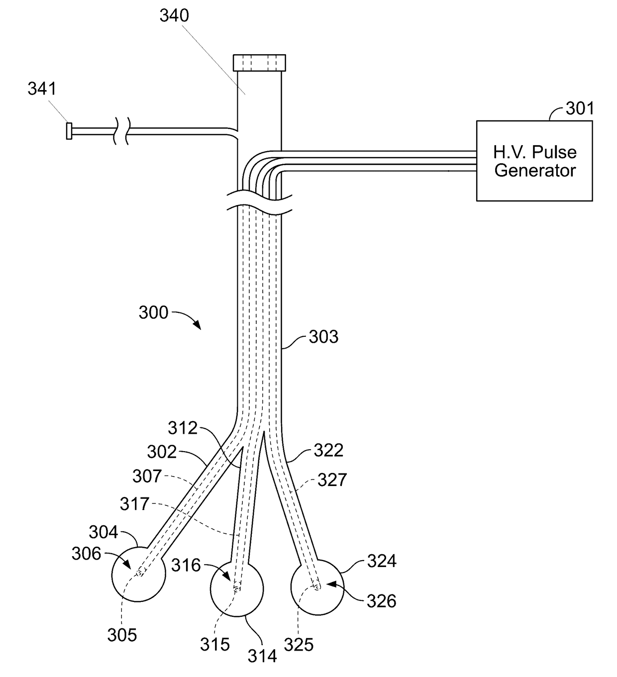 Shock wave valvuloplasty with multiple balloons