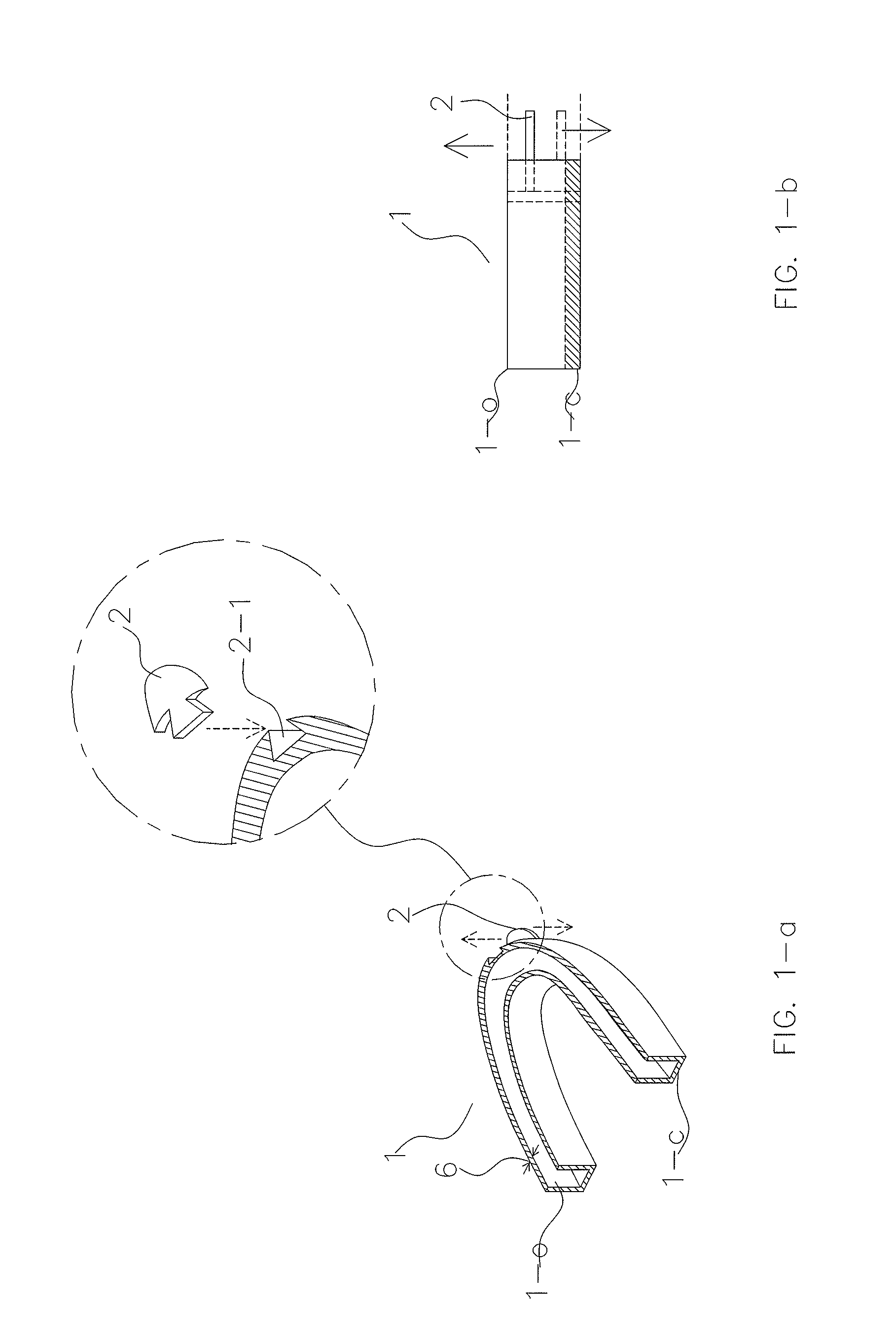 AGP night guard - for a bruxism patient with or without a severe malocclusion