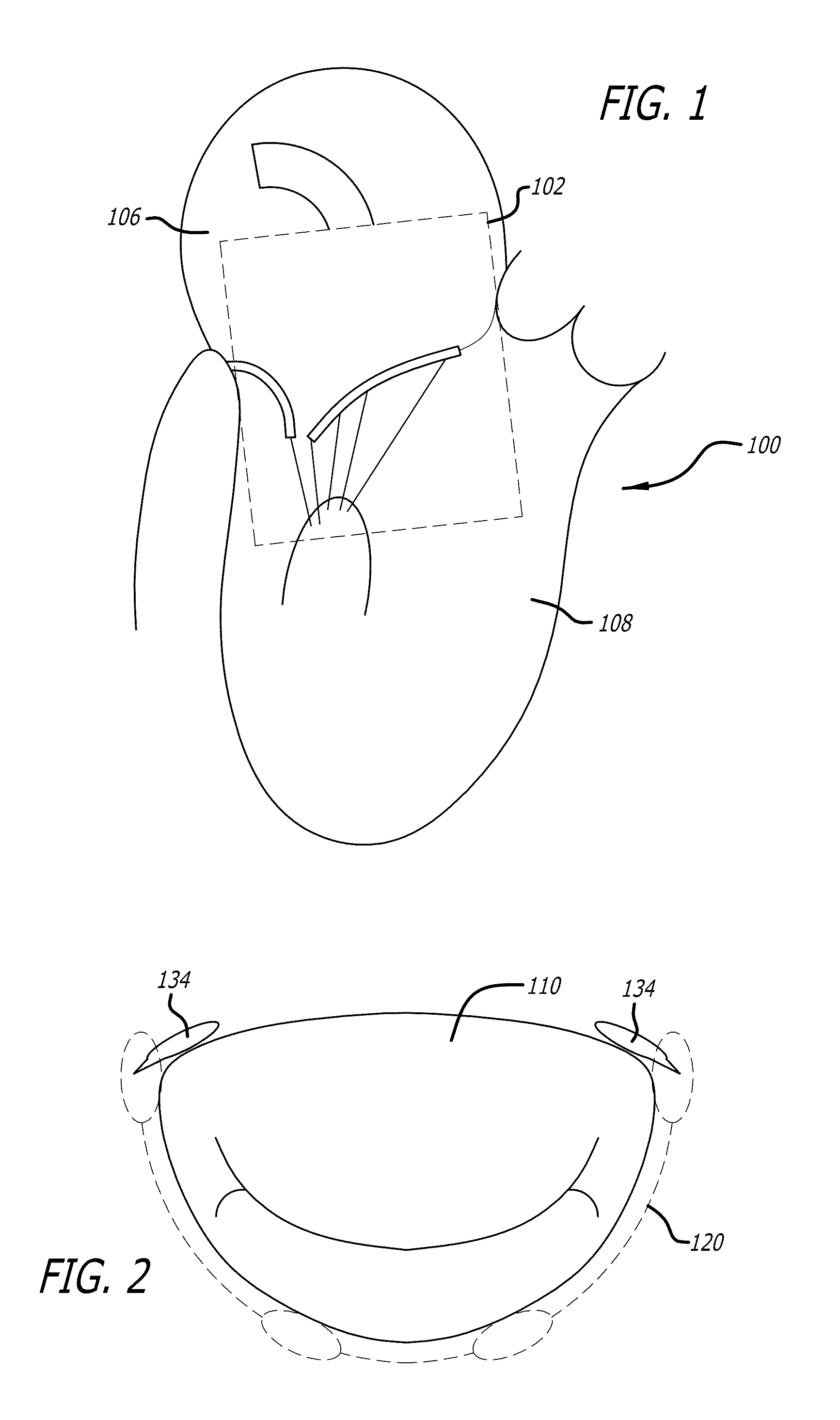 Methods and systems for heart valve therapy