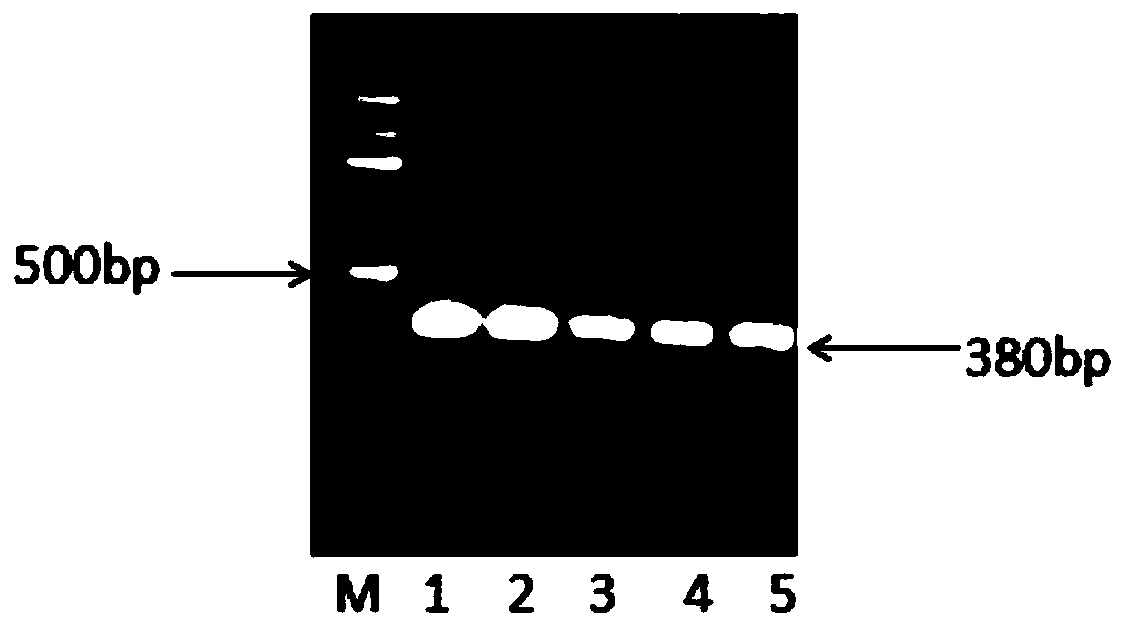 Recombinant vector as well as construction method and application thereof