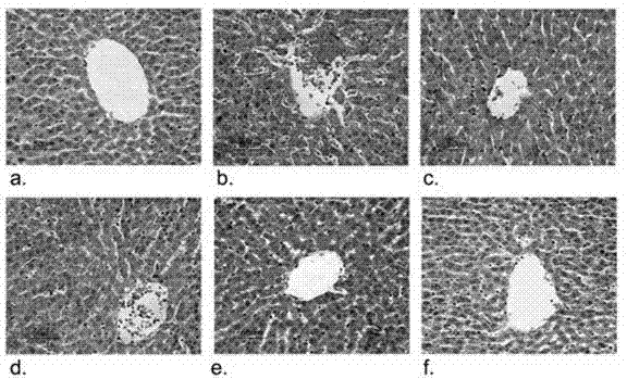 Application of compound thrombosis capsule inn aspect of liver protection