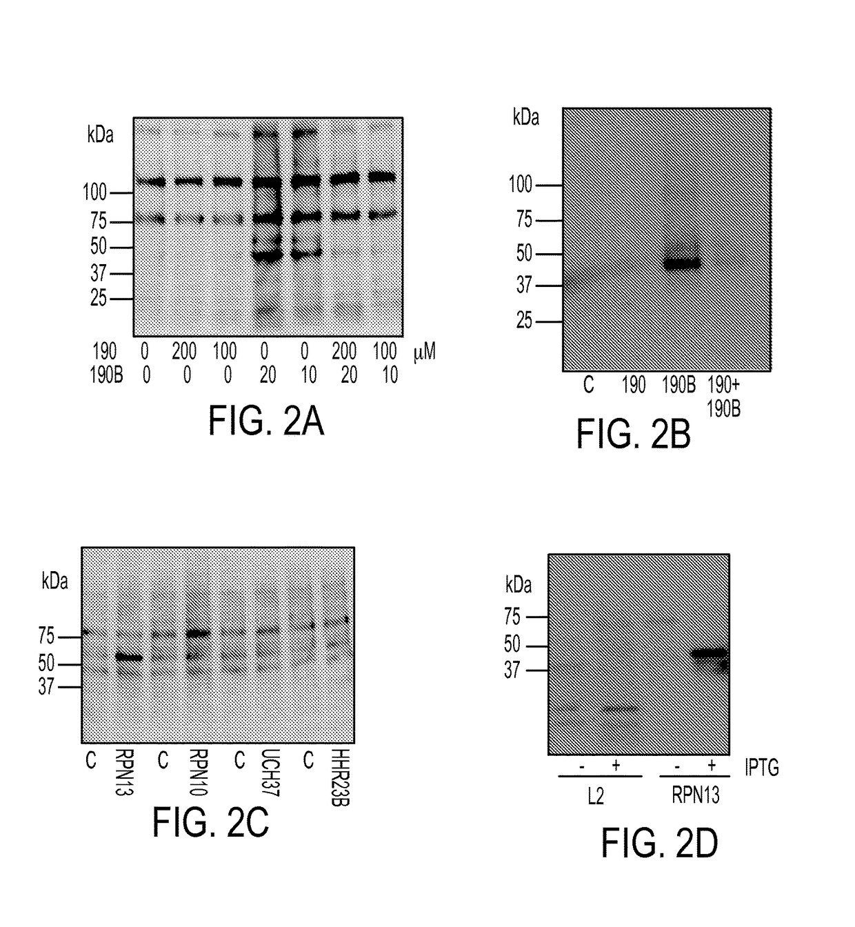 Bis-benzylidine piperidone proteasome inhibitor with anticancer activity