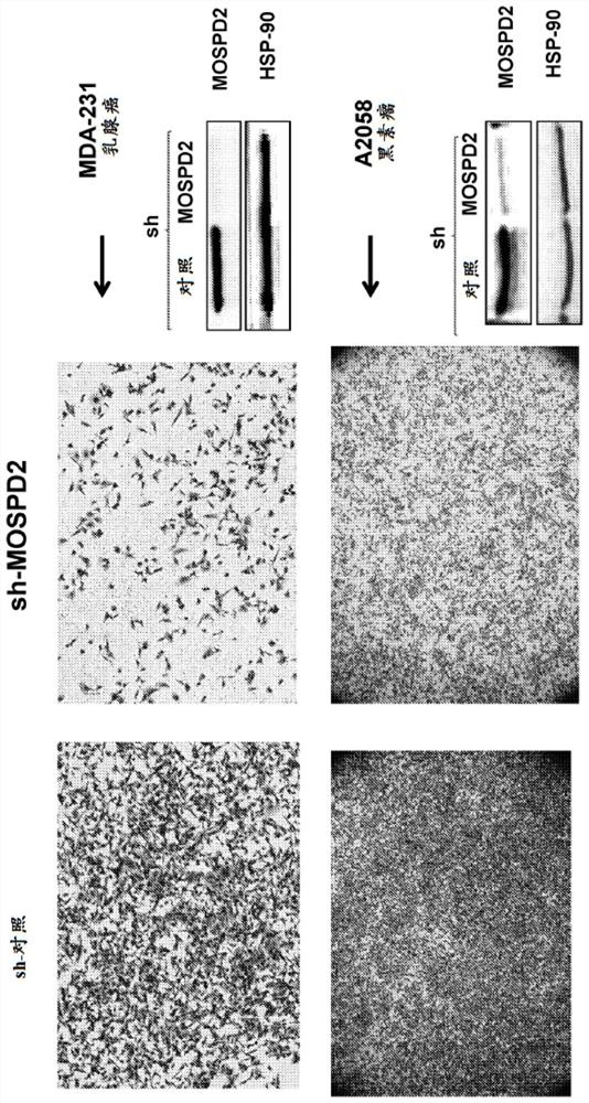 Motile sperm domain-containing protein 2 and cancer