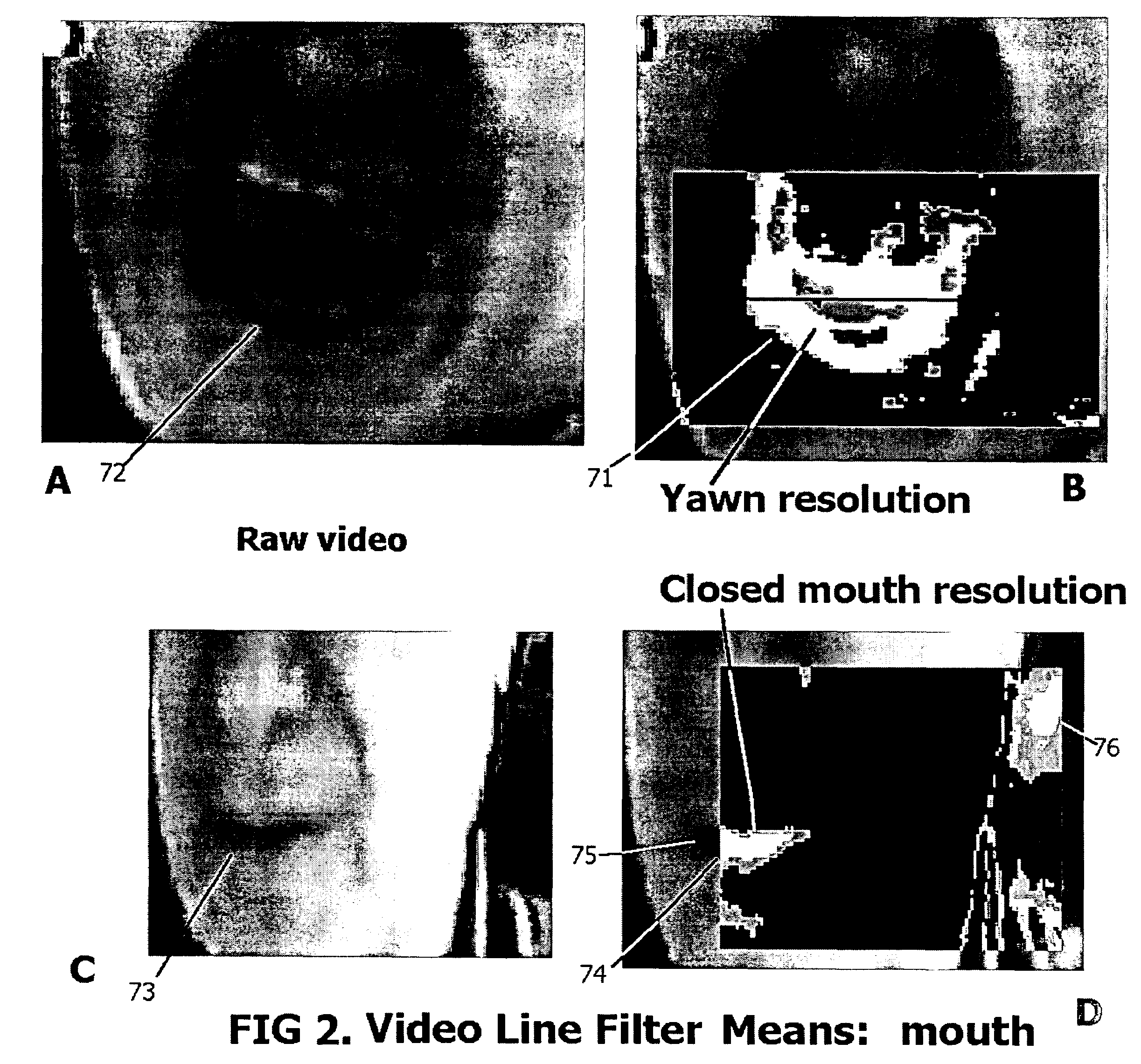 Method and apparatus for detection of drowsiness and quantitative control of biological processes