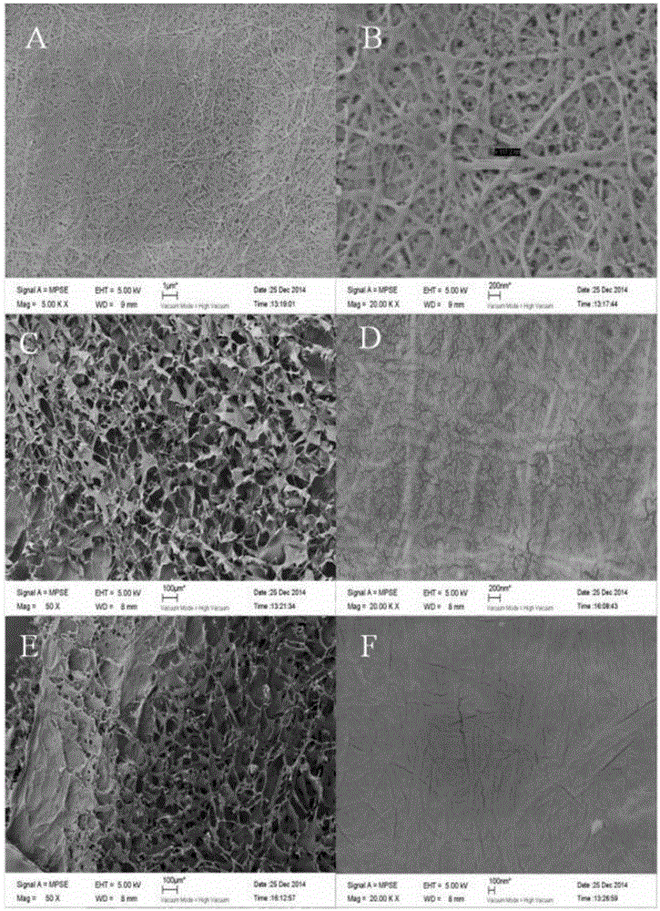 Preparation method of antibacterial composite bacterial cellulose membrane