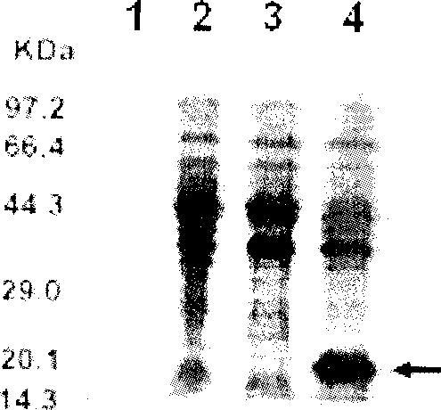 Preparation and detection kit for human ARMET protein monoclonal antibody