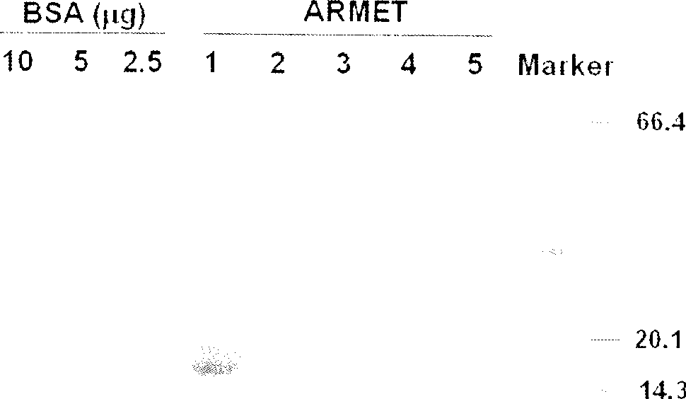 Preparation and detection kit for human ARMET protein monoclonal antibody