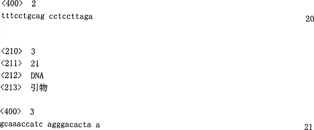 Method and kit for detecting susceptibility of ankylosing spondylitis