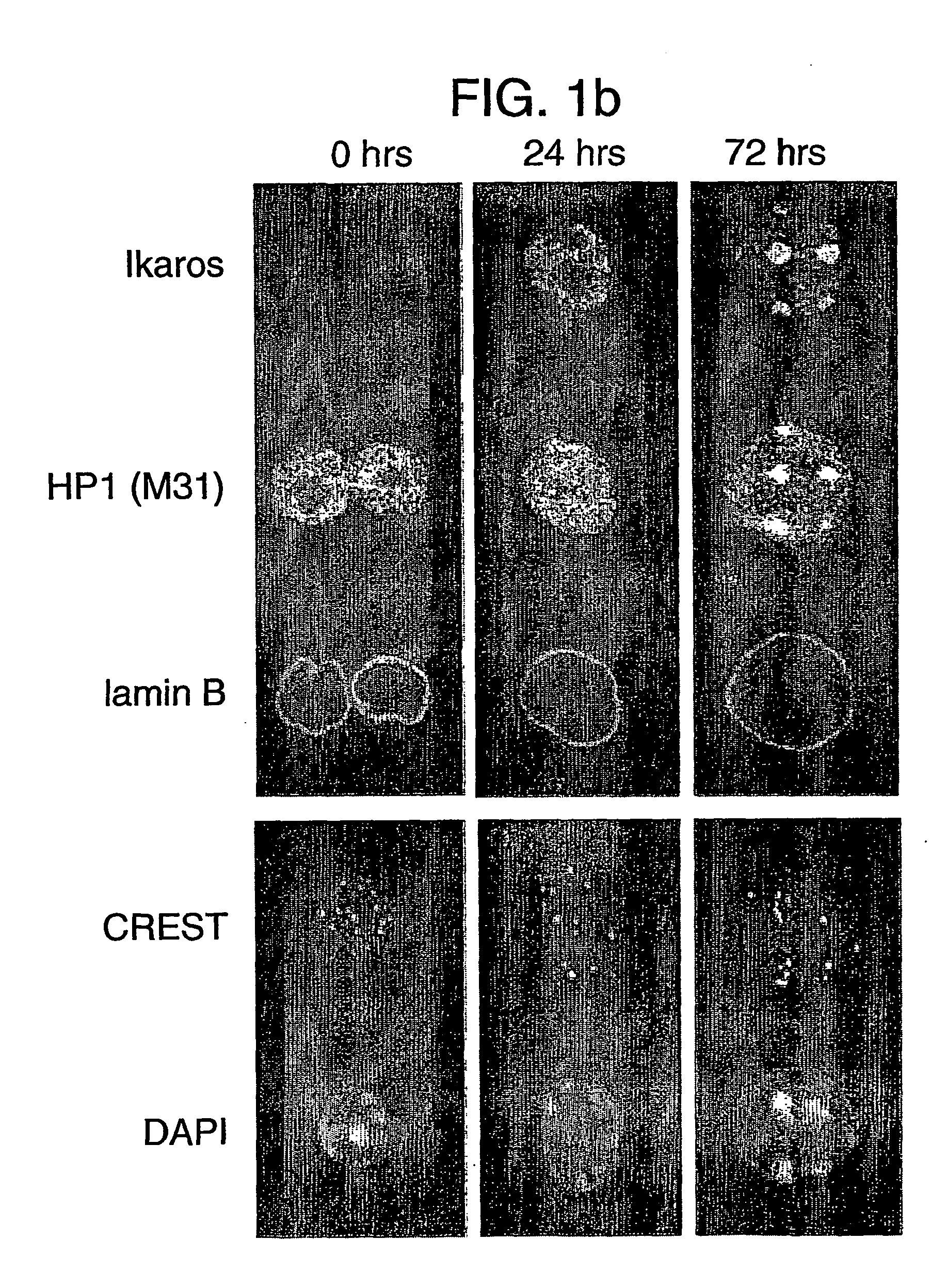 Nuclear transfer nuclei from histone hypomethylated donor cells