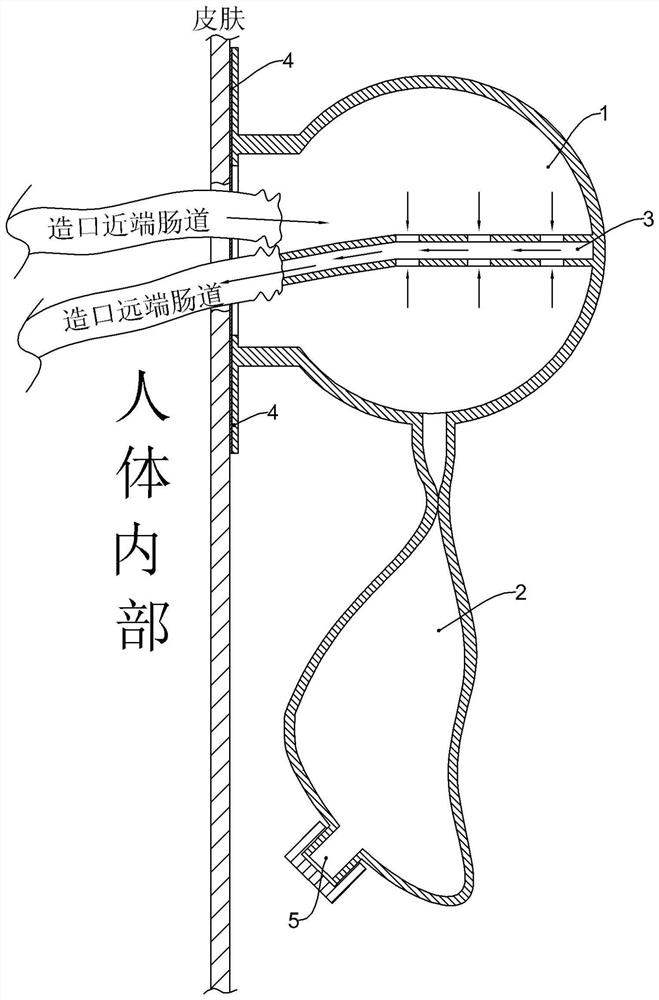 Turnover device and method for intestinal feces