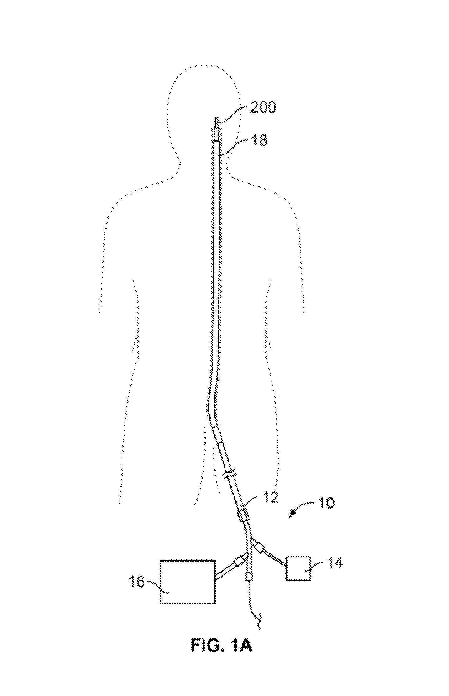 Retrieval systems and methods for use thereof