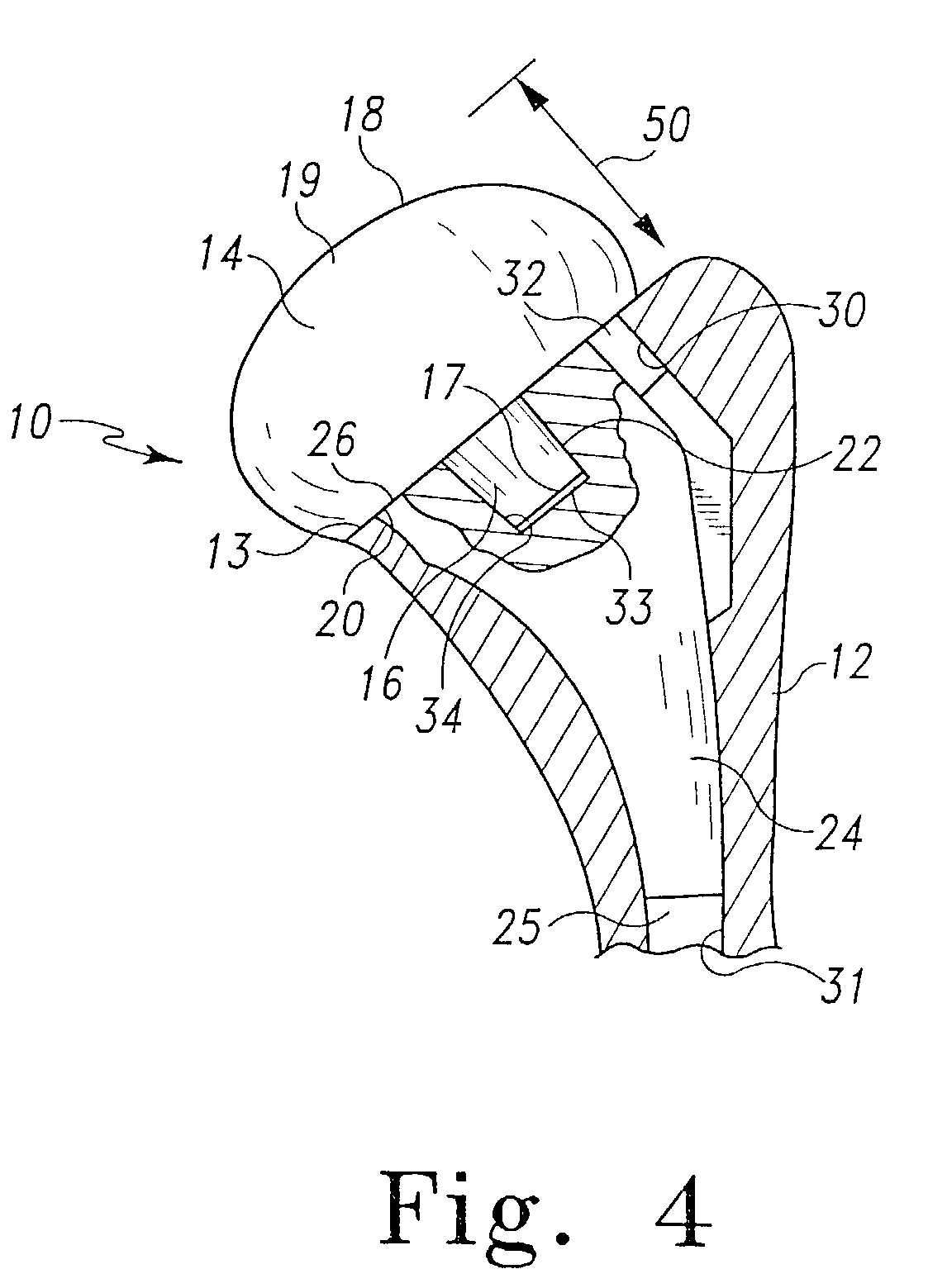 Collarless shoulder arthroplasty prosthesis