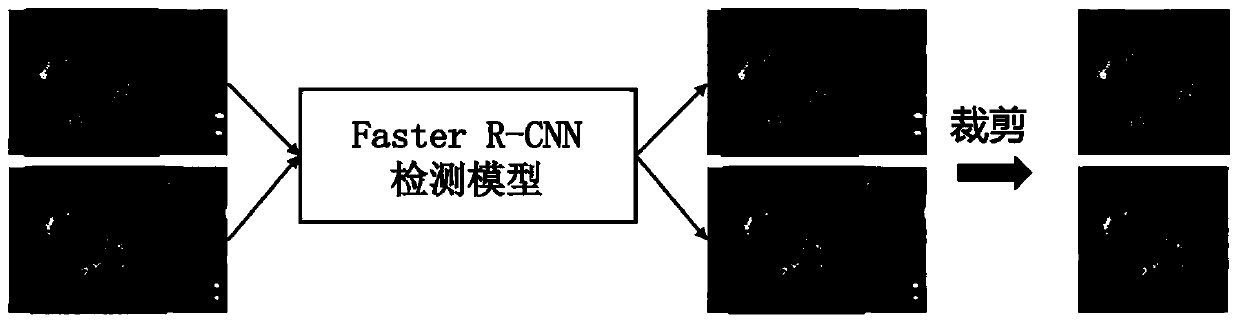 Cervical lesion prediction system based on multi-modal feature level fusion