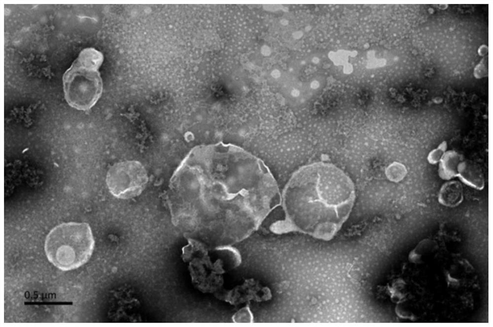 Application of mesenchymal stem cell apoptotic body to preparation of medicine for treating bone defects