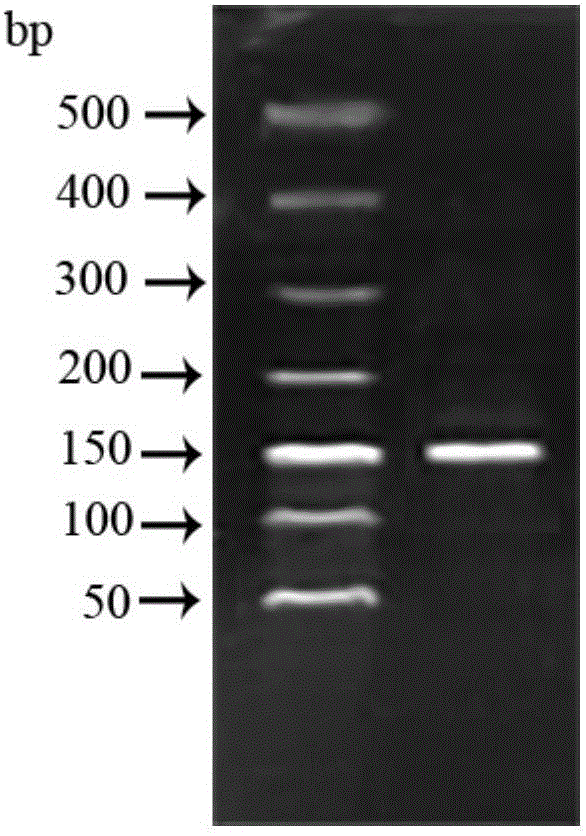 Kit for detecting MyD88 gene expression of odontobutis potamophila based on fluorescence RT-RCR and applications of kit