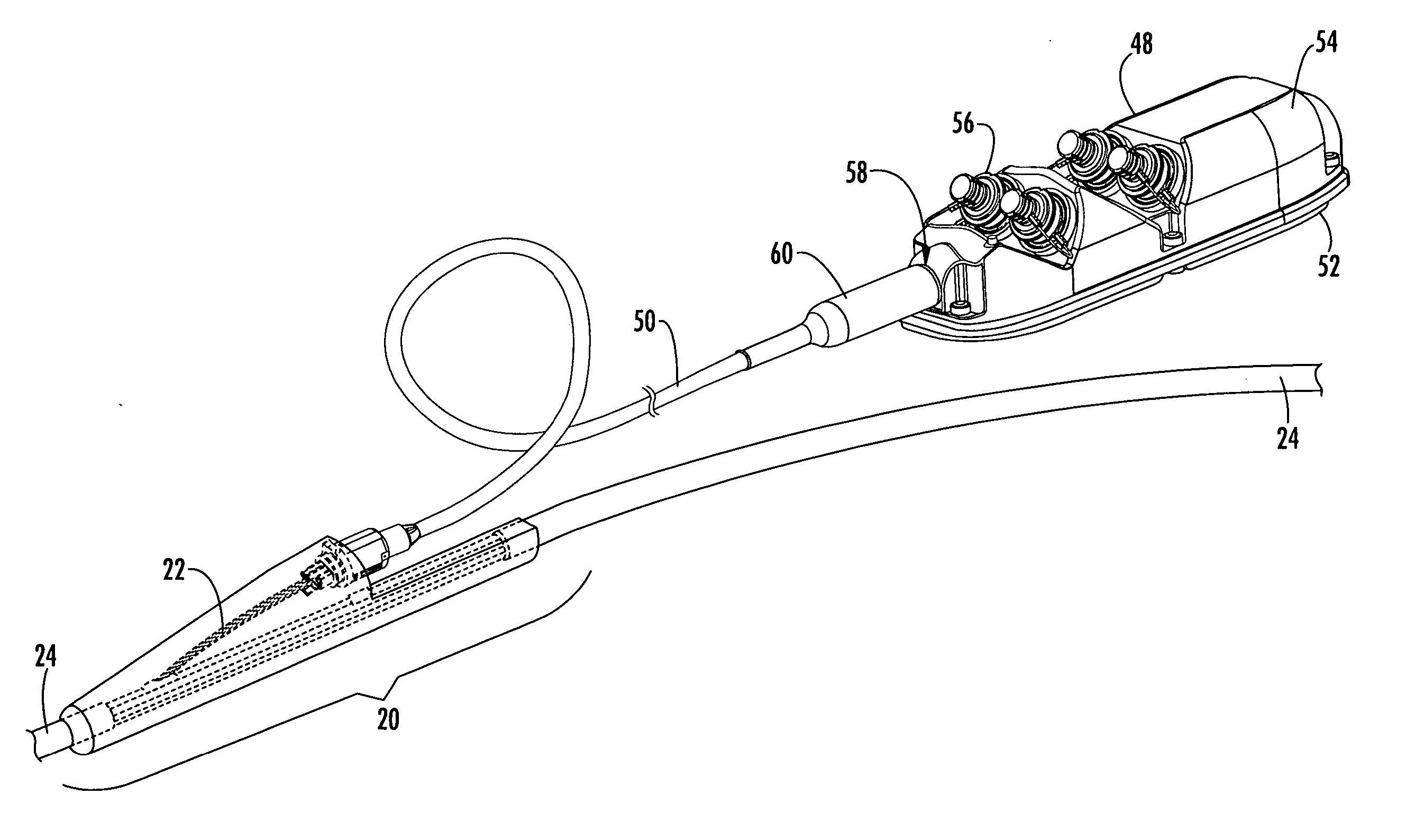 Pre-connectorized fiber optic distribution cable having overmolded access location