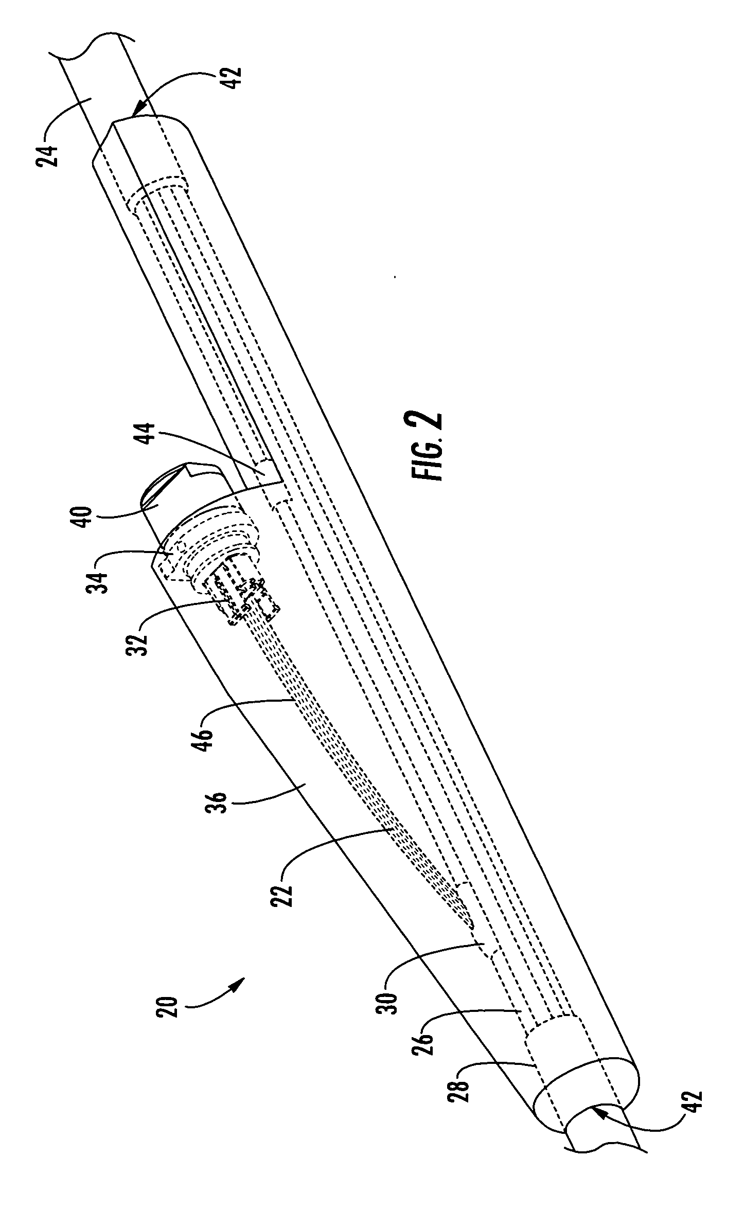 Pre-connectorized fiber optic distribution cable having overmolded access location