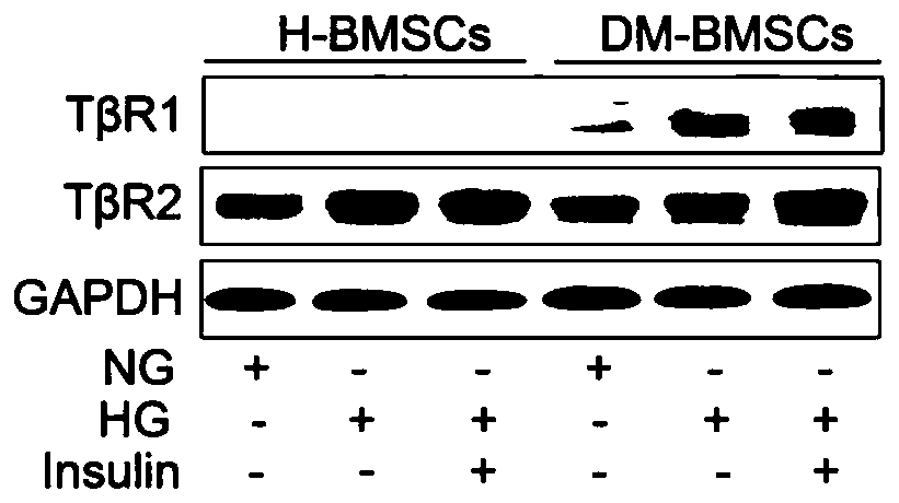 Application of TGF-beta 1 inhibitor in preparation of drugs to treat diabetic bone healing disorder