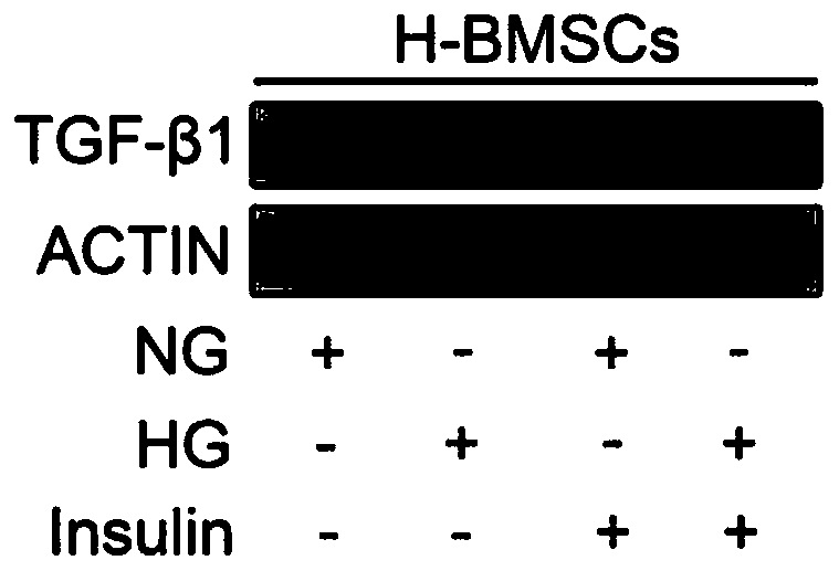 Application of TGF-beta 1 inhibitor in preparation of drugs to treat diabetic bone healing disorder