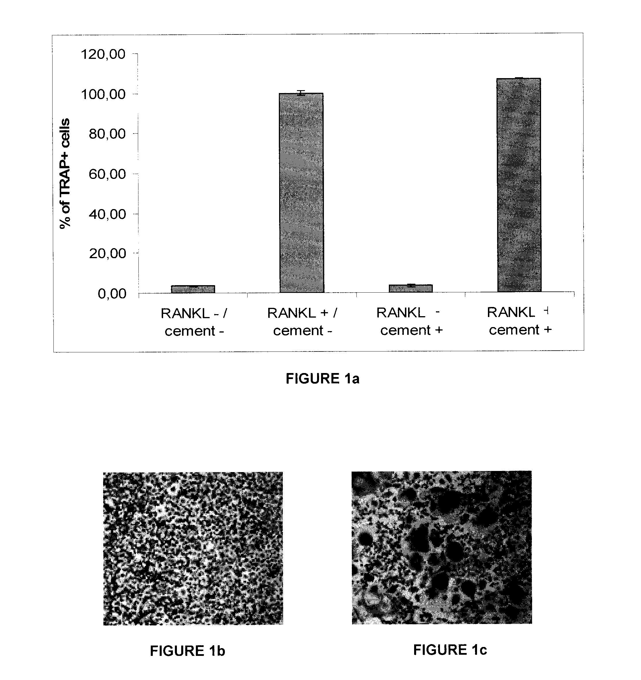 Composition for enhancing bone formation