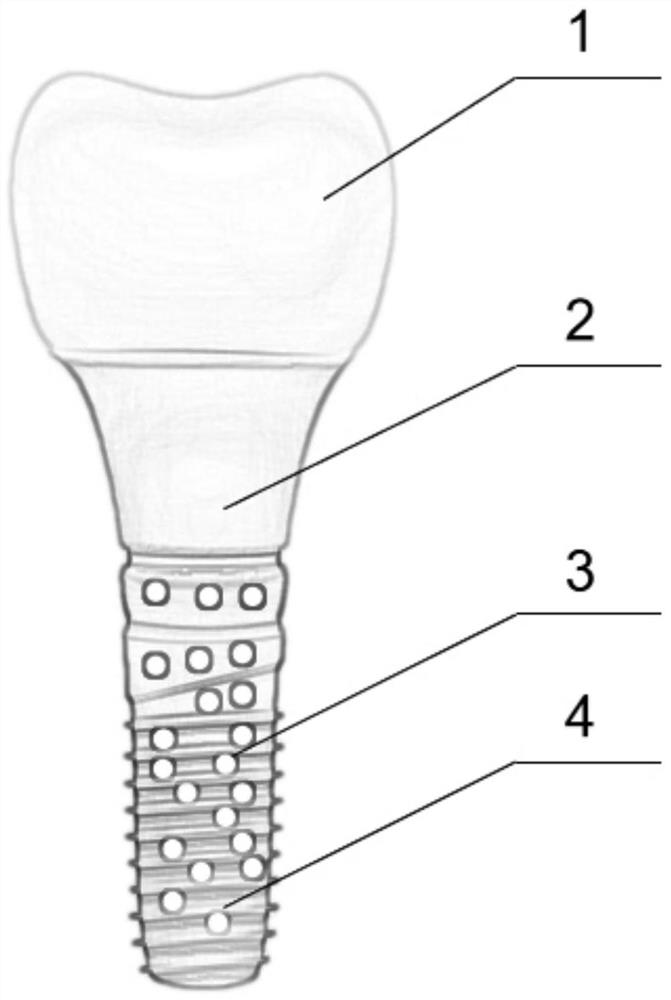 Novel ceramic dental implant and preparation method thereof