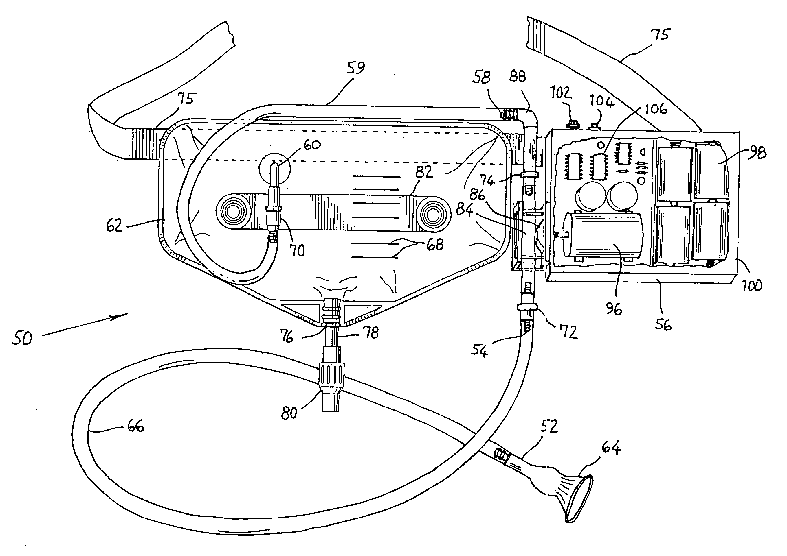 Urine pump for condom catheters and method for using