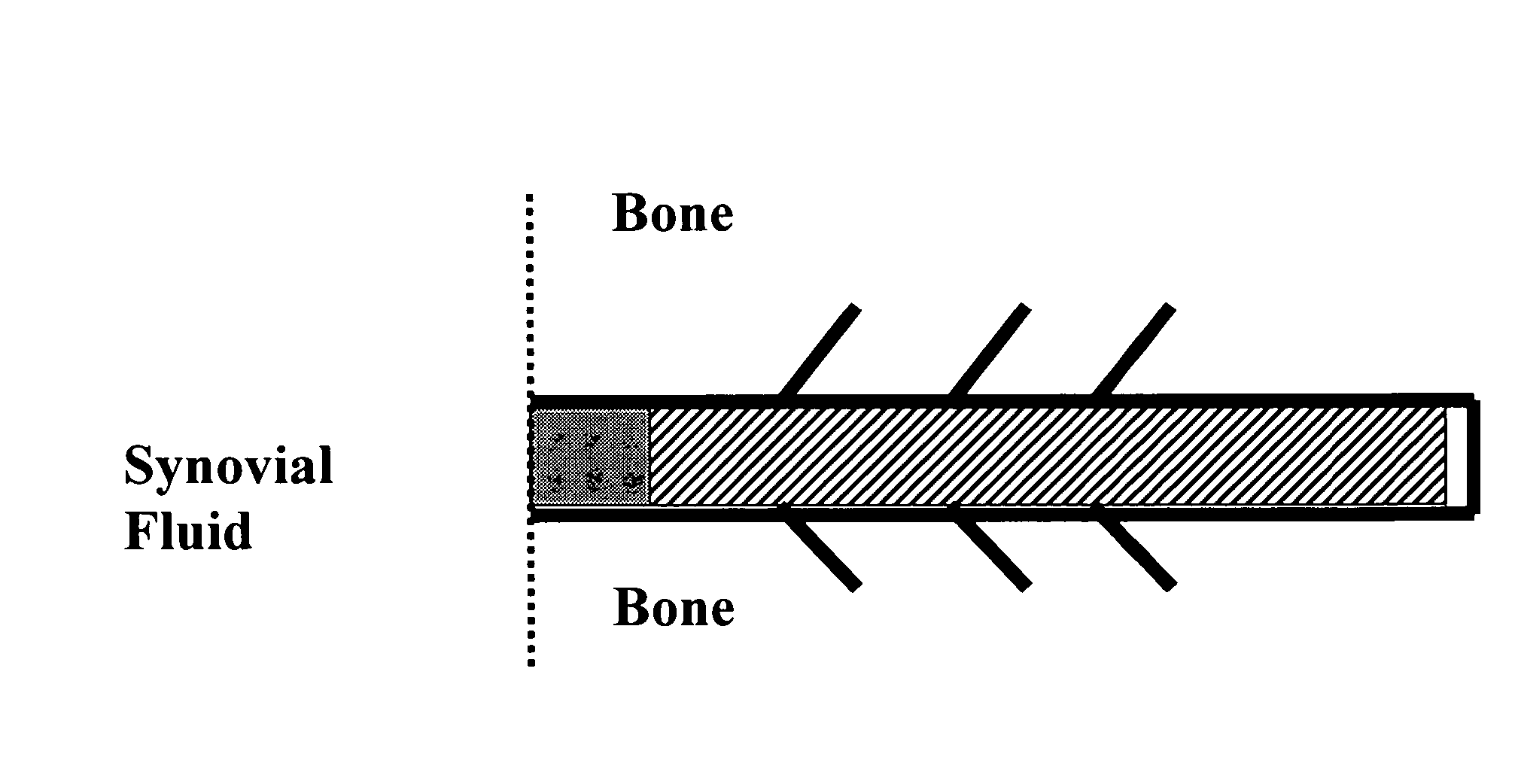 Drug delivery to a joint