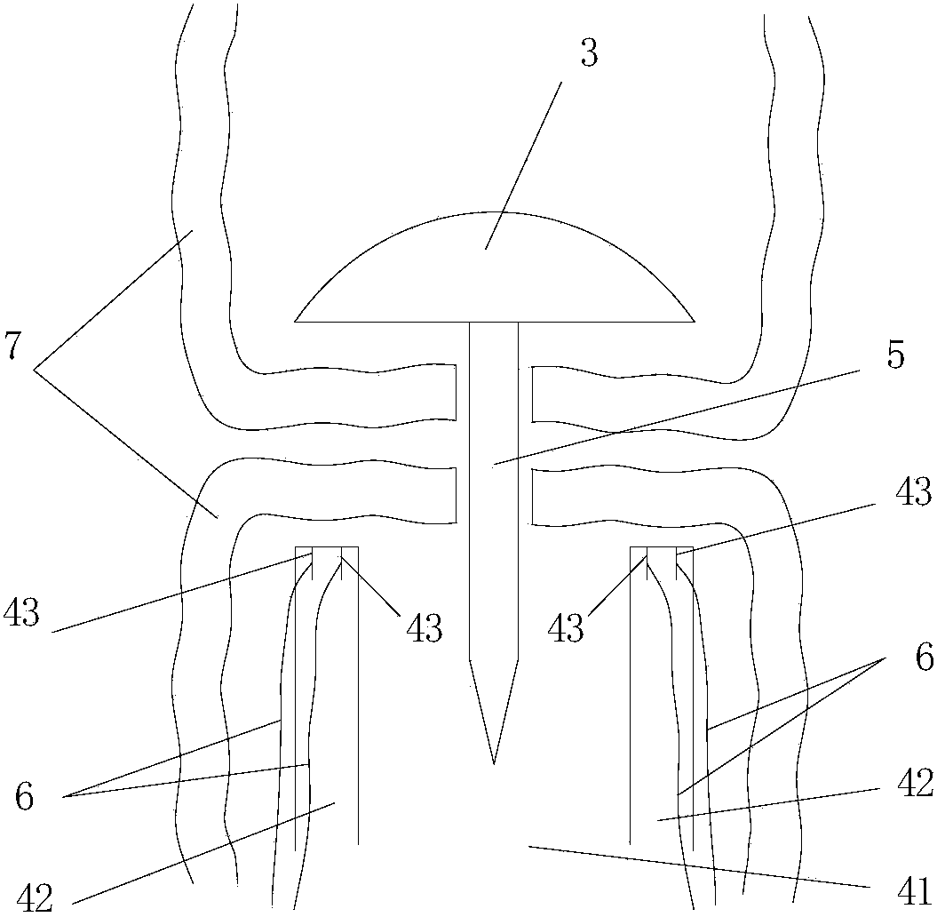 Tubular anastomat with pull wire