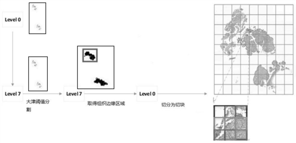 Lung canceration region segmentation and classification detection system