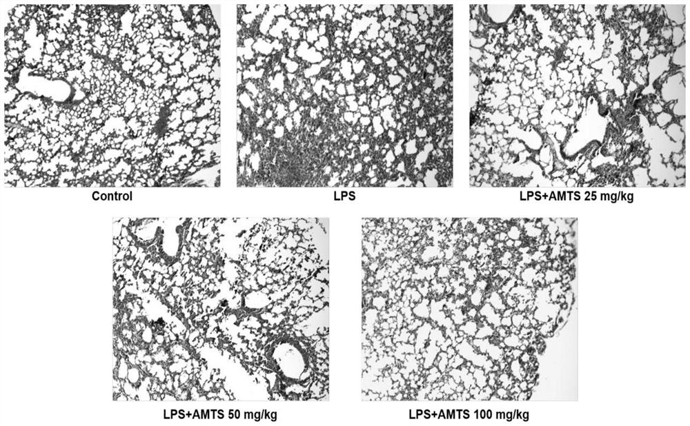 Use of methallyl trisulfide in the preparation of medicines for treating acute lung injury