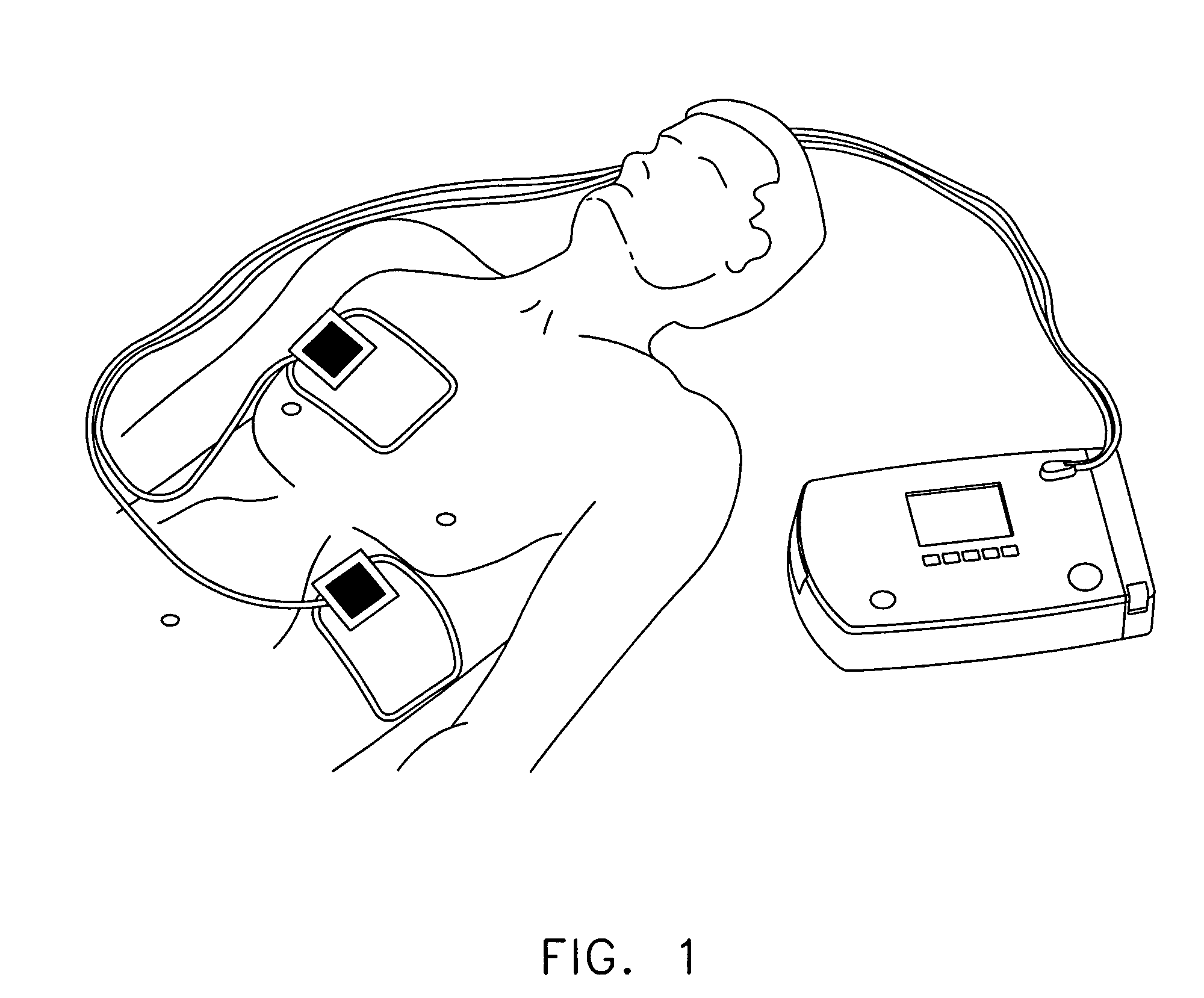 Automated external defibrillator (AED) system with multiple patient wireless monitoring capability for use in mass casualty incidents