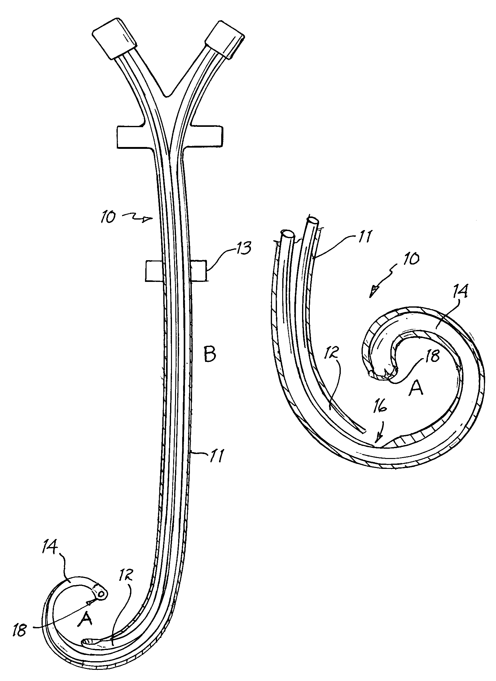 Vascular access catheter having a curved tip and method