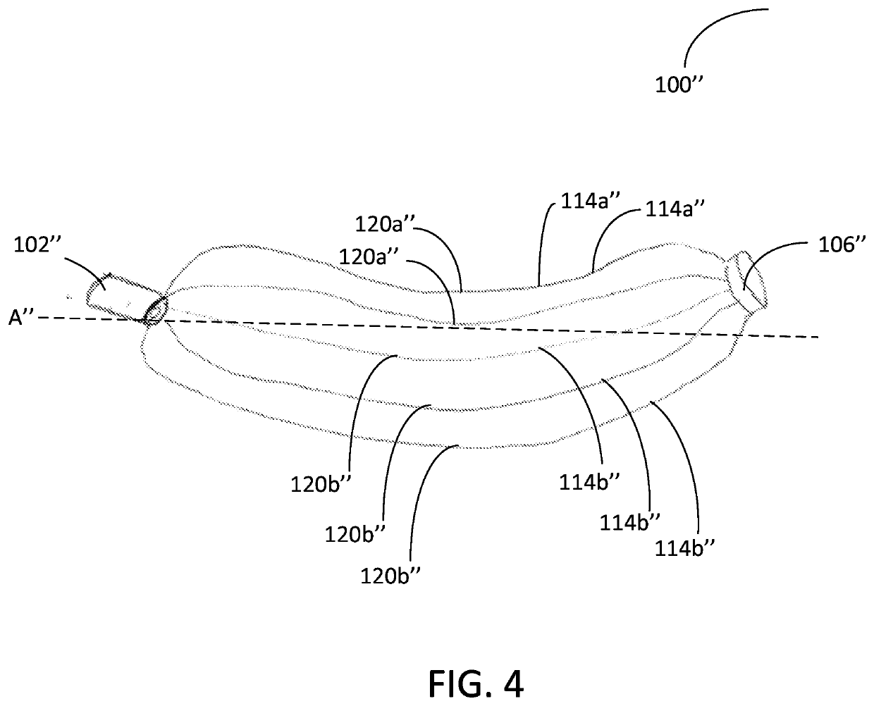 Patent ductus arteriosus stent