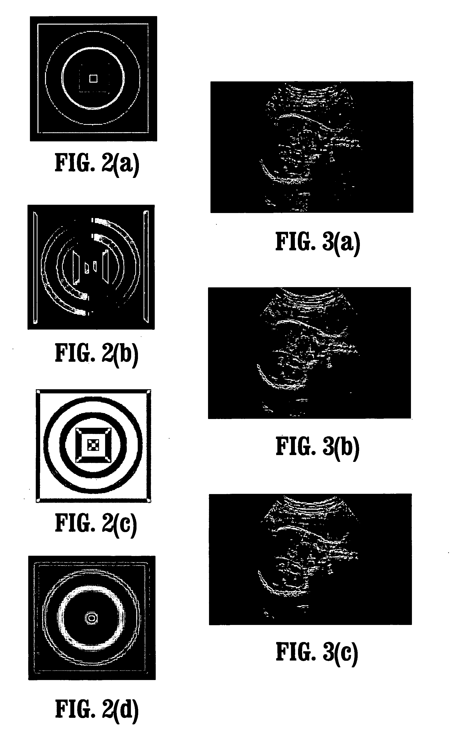 System and method for efficient feature estimation for medical images