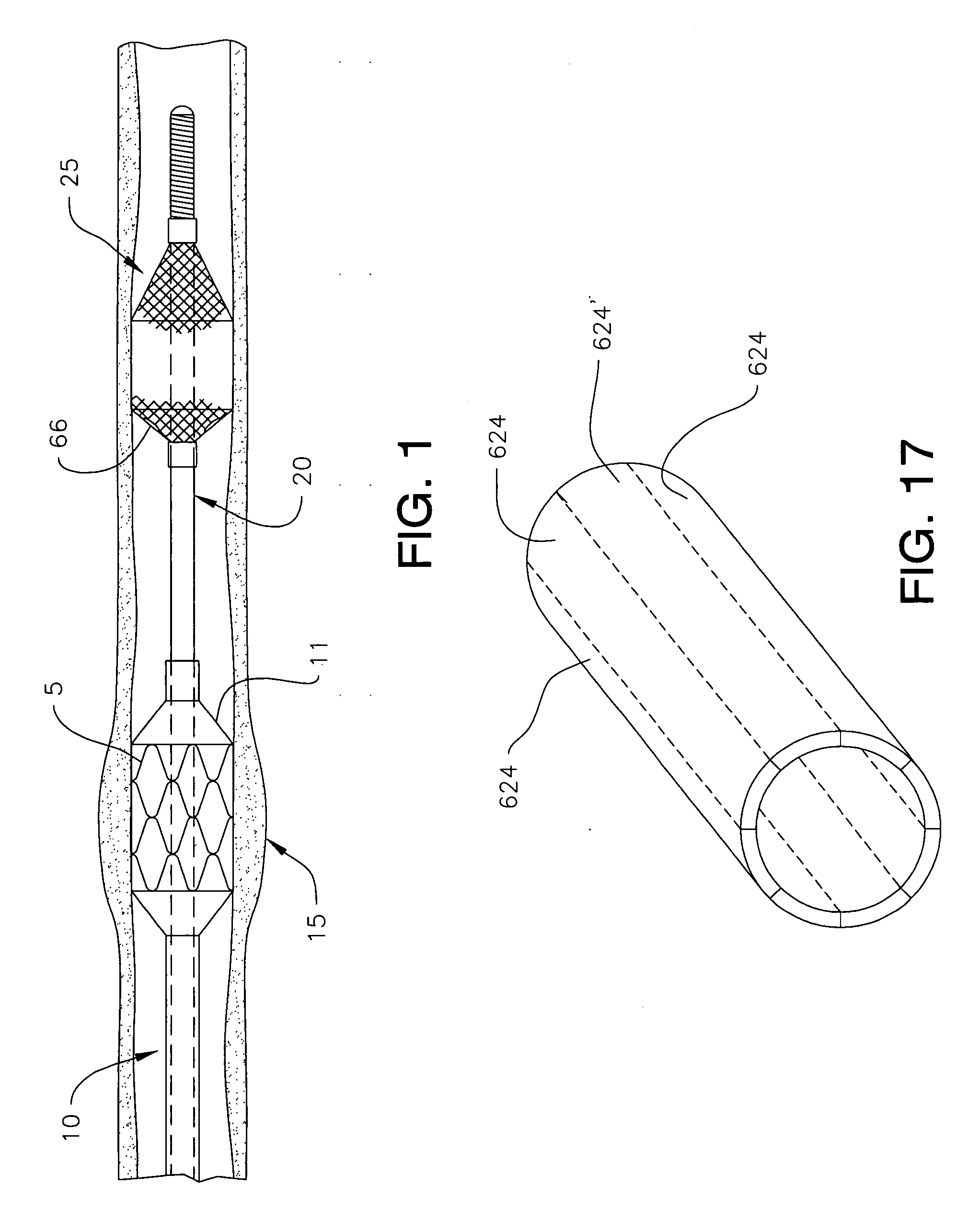 Steerable distal protection guidewire and methods of use